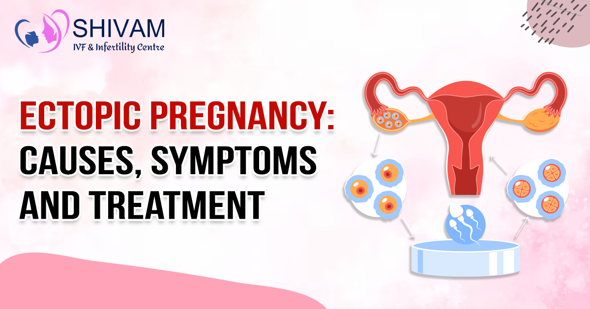 ectopic pregnancy, ectopic pregnancy treatment, ectopic pregnancy causes, ectopic pregnancy types, what is ectopic pregnancy, ectopic pregnancy meaning, ectopic pregnancy information, what is an ectopic pregnancy,